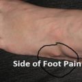 10 Problems That Causes Side Of Foot Pain Or Lateral Ankle Pain
