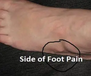 10 Problems That Causes Side Of Foot Pain Or Lateral Ankle Pain