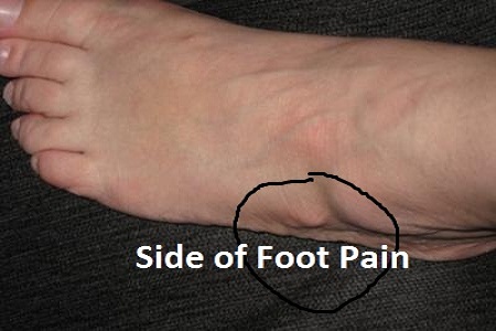 Foot Pain or Lateral Ankle Pain